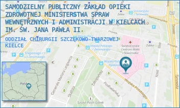 ODDZIAŁ CHIRURGII SZCZĘKOWO-TWARZOWEJ - SAMODZIELNY PUBLICZNY ZAKŁAD OPIEKI ZDROWOTNEJ MINISTERSTWA SPRAW WEWNĘTRZNYCH I ADMINISTRACJI W KIELCACH IM. ŚW. JANA PAWŁA II - WOJSKA POLSKIEGO 51, KIELCE